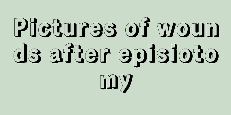 Pictures of wounds after episiotomy