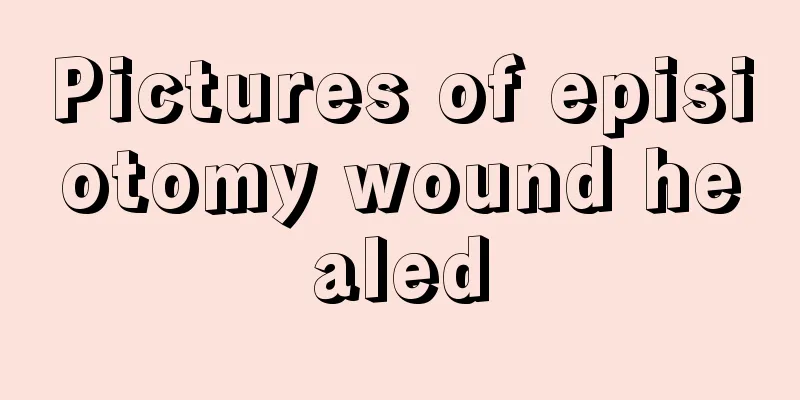 Pictures of episiotomy wound healed