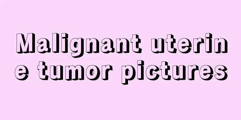 Malignant uterine tumor pictures