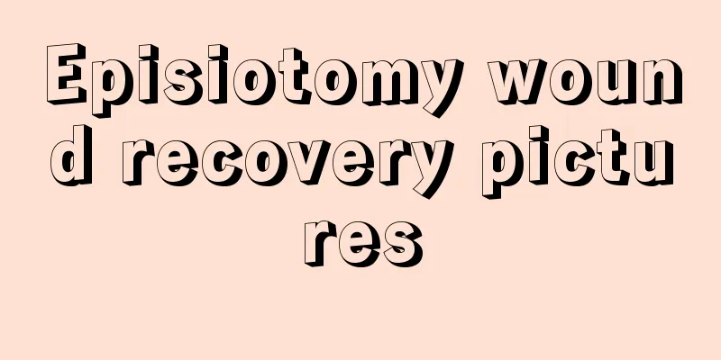 Episiotomy wound recovery pictures