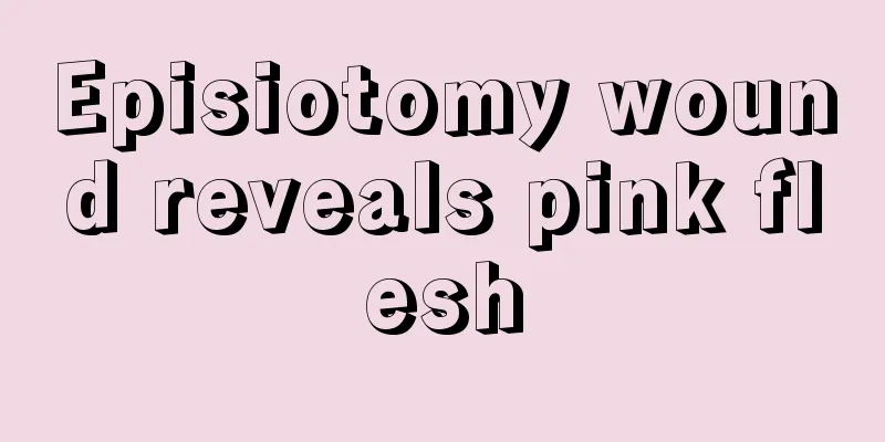 Episiotomy wound reveals pink flesh