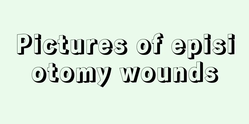 Pictures of episiotomy wounds