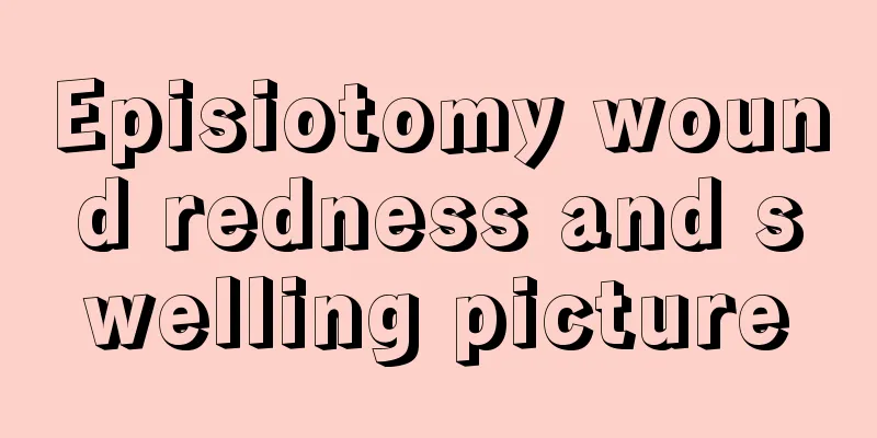 Episiotomy wound redness and swelling picture