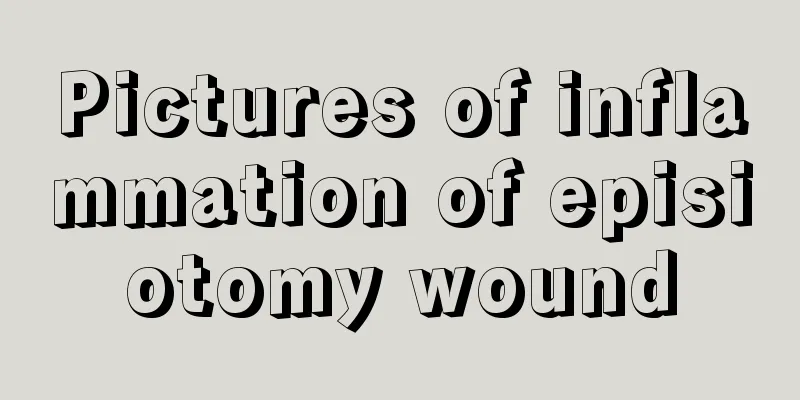 Pictures of inflammation of episiotomy wound