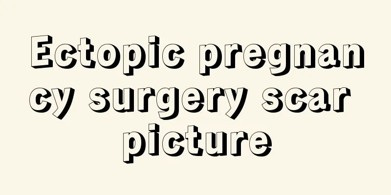 Ectopic pregnancy surgery scar picture