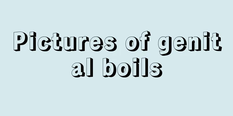 Pictures of genital boils