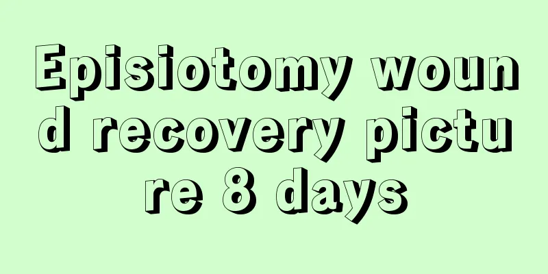 Episiotomy wound recovery picture 8 days