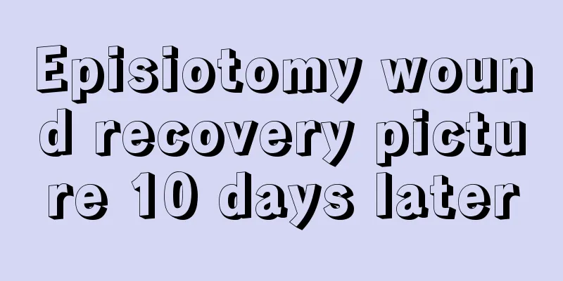 Episiotomy wound recovery picture 10 days later