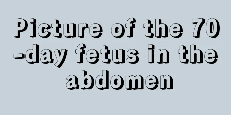 Picture of the 70-day fetus in the abdomen