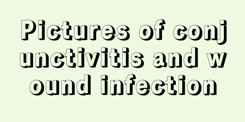 Pictures of conjunctivitis and wound infection