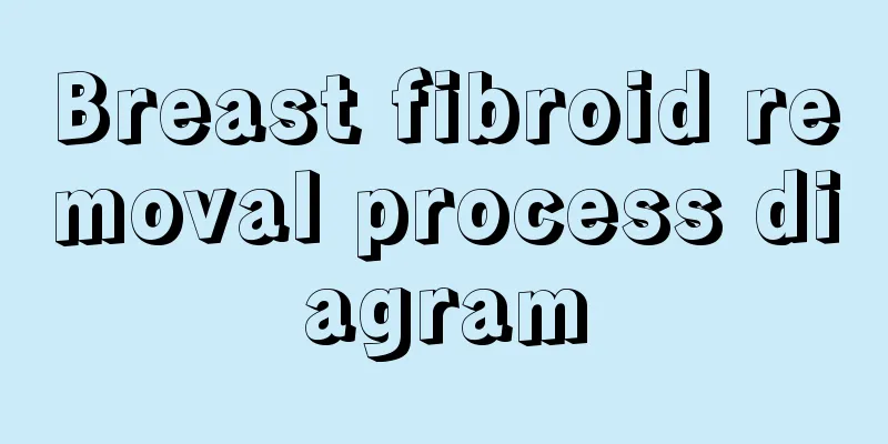 Breast fibroid removal process diagram