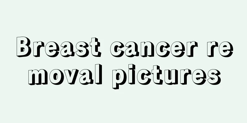 Breast cancer removal pictures