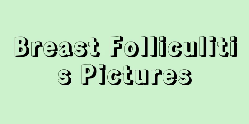 Breast Folliculitis Pictures