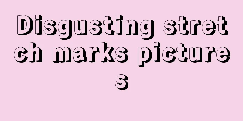 Disgusting stretch marks pictures