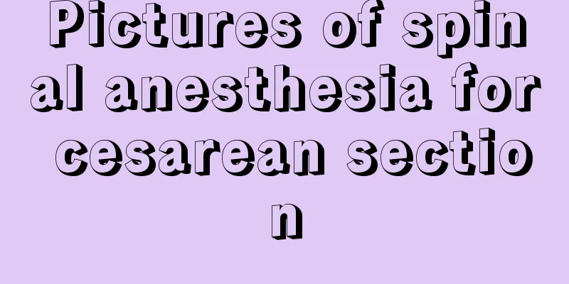 Pictures of spinal anesthesia for cesarean section