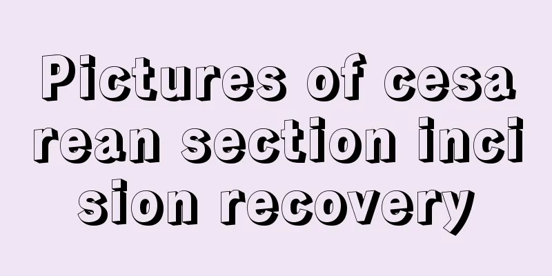 Pictures of cesarean section incision recovery