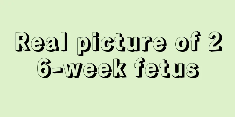 Real picture of 26-week fetus