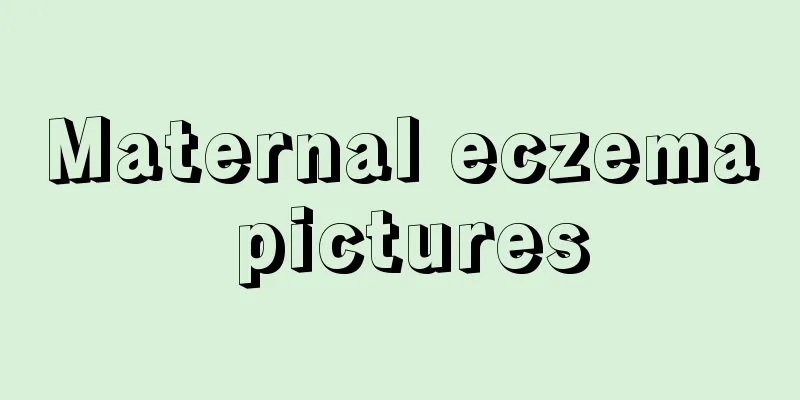 Maternal eczema pictures