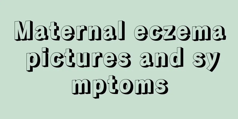 Maternal eczema pictures and symptoms