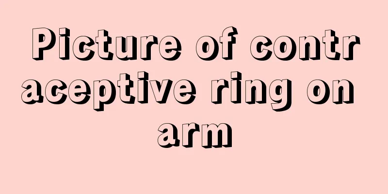 Picture of contraceptive ring on arm