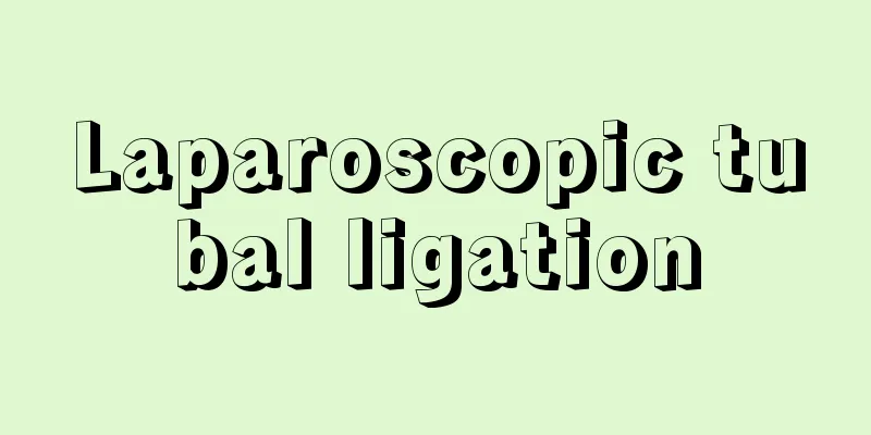 Laparoscopic tubal ligation