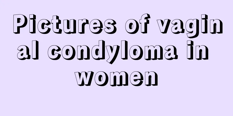 Pictures of vaginal condyloma in women