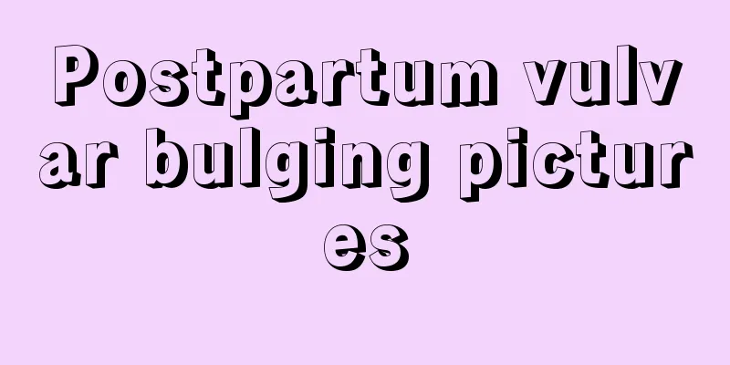 Postpartum vulvar bulging pictures