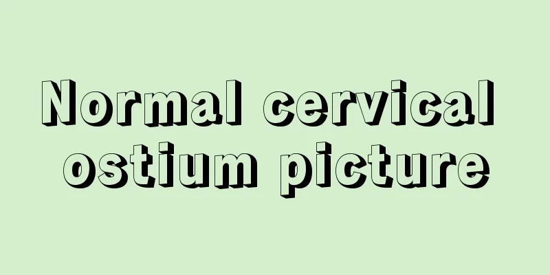 Normal cervical ostium picture