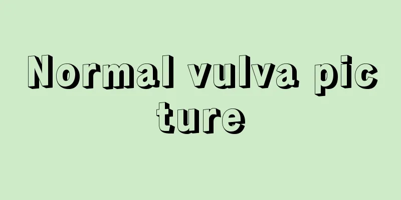 Normal vulva picture