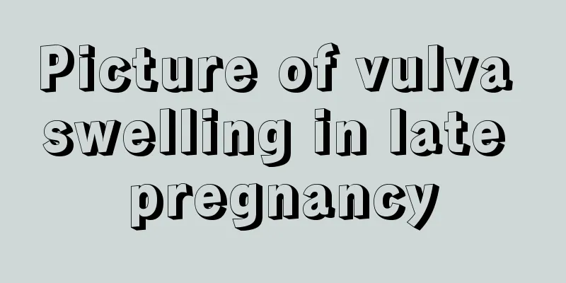 Picture of vulva swelling in late pregnancy