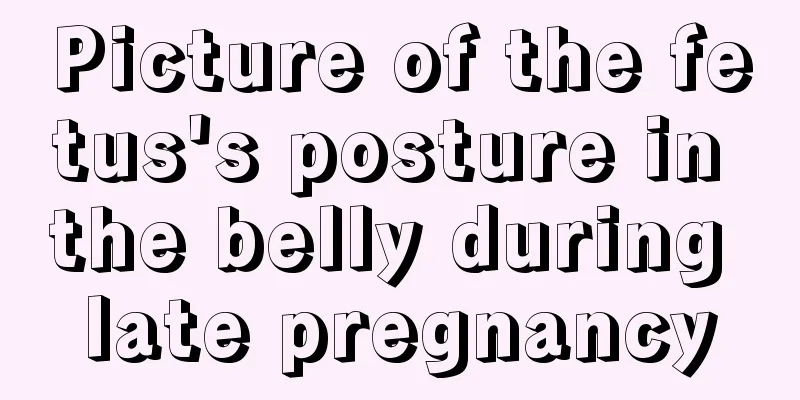 Picture of the fetus's posture in the belly during late pregnancy