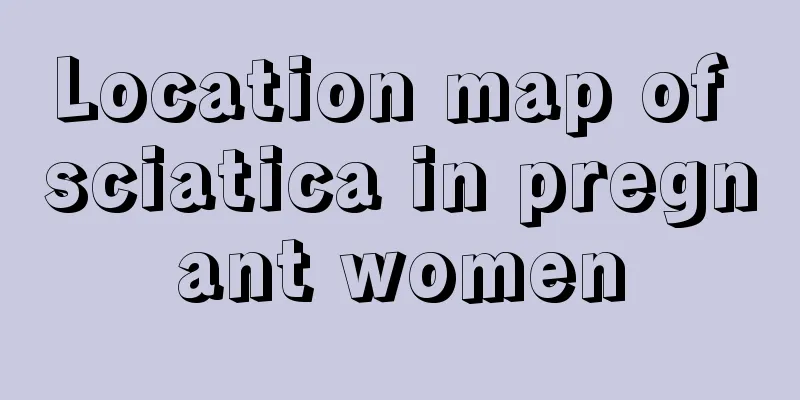 Location map of sciatica in pregnant women