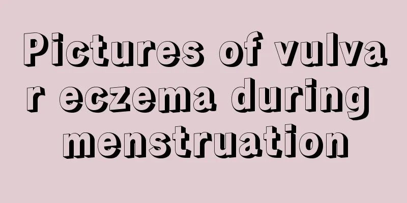 Pictures of vulvar eczema during menstruation