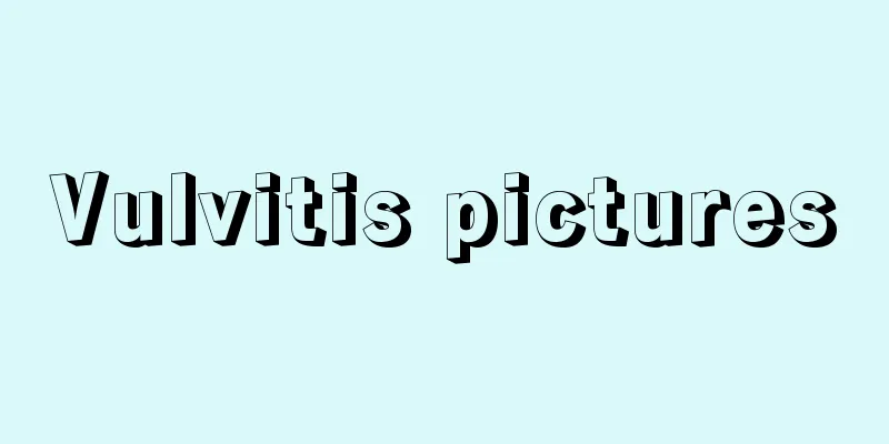 Vulvitis pictures