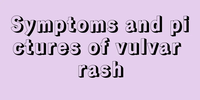 Symptoms and pictures of vulvar rash