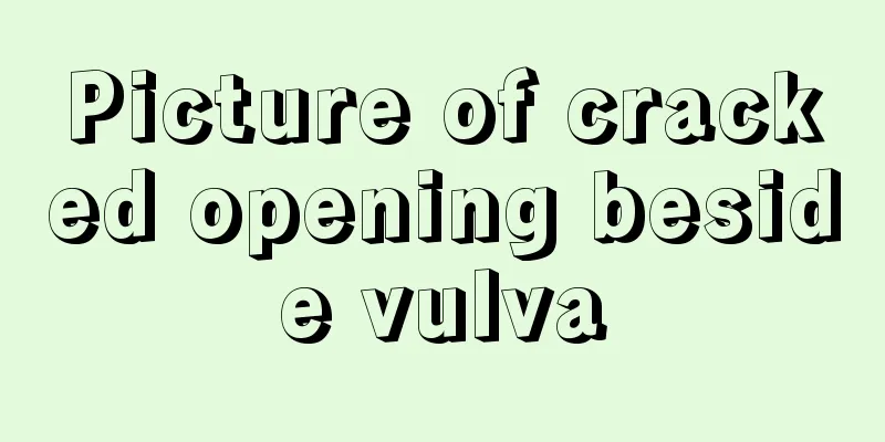 Picture of cracked opening beside vulva