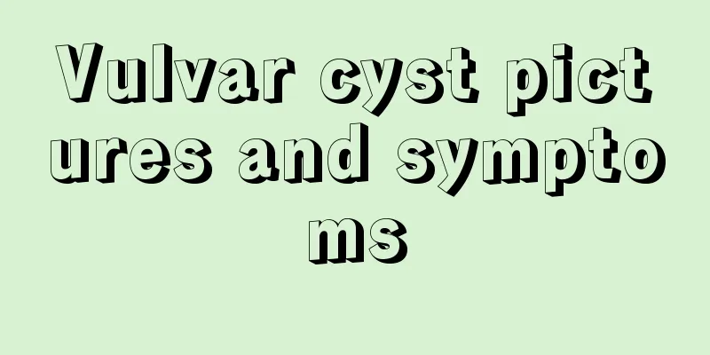 Vulvar cyst pictures and symptoms