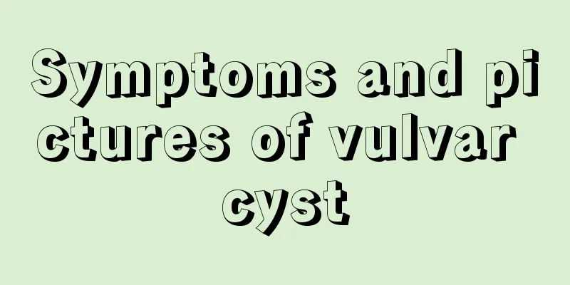 Symptoms and pictures of vulvar cyst