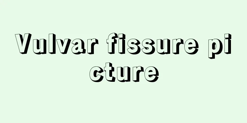 Vulvar fissure picture