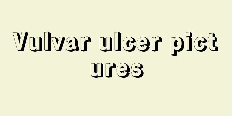 Vulvar ulcer pictures