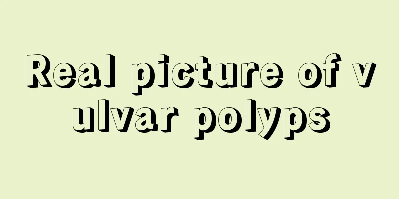 Real picture of vulvar polyps