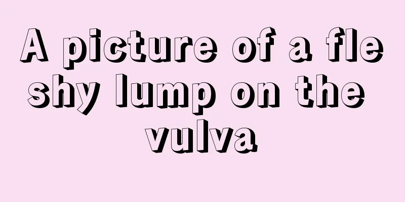 A picture of a fleshy lump on the vulva