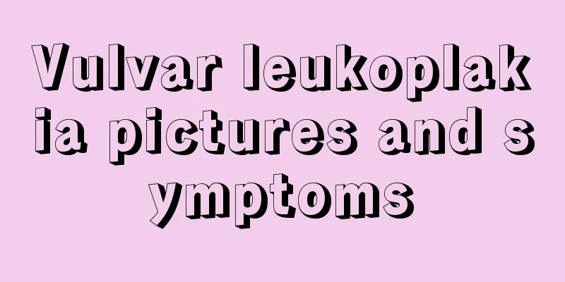 Vulvar leukoplakia pictures and symptoms