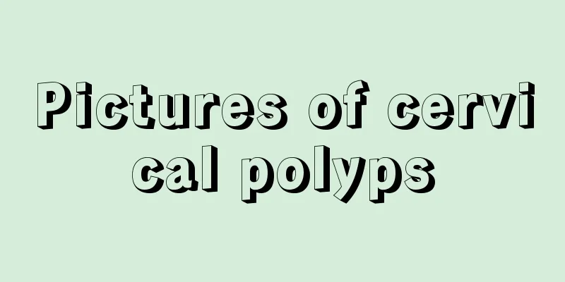 Pictures of cervical polyps