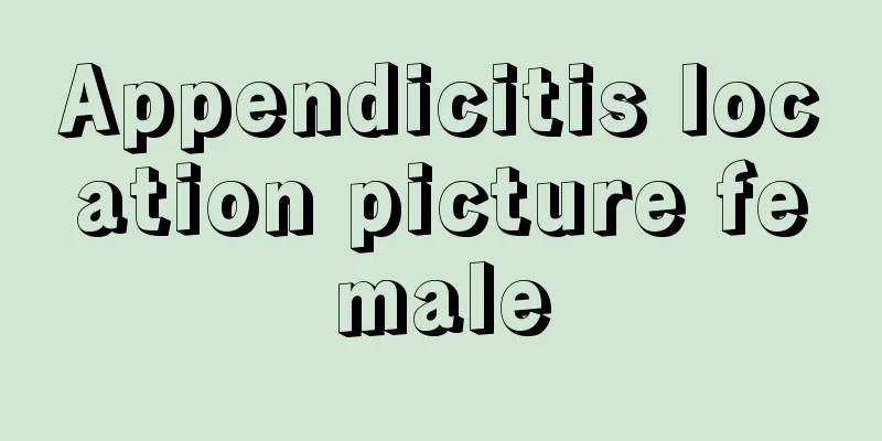 Appendicitis location picture female