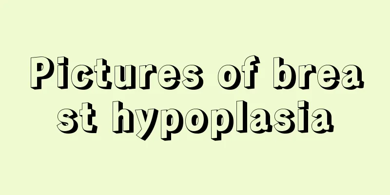 Pictures of breast hypoplasia