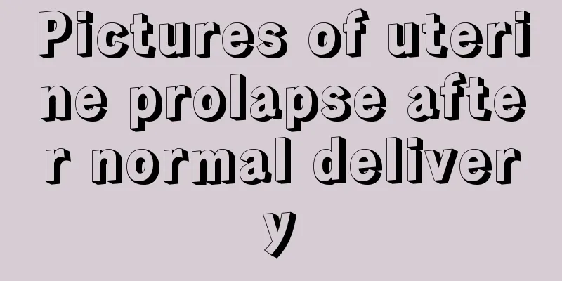 Pictures of uterine prolapse after normal delivery