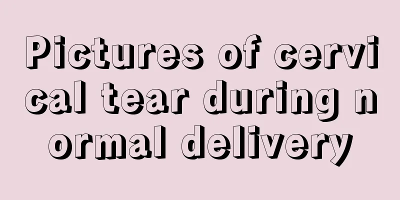 Pictures of cervical tear during normal delivery