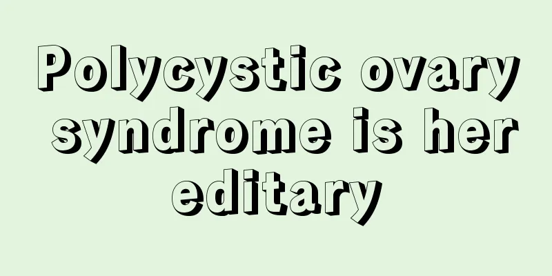 Polycystic ovary syndrome is hereditary