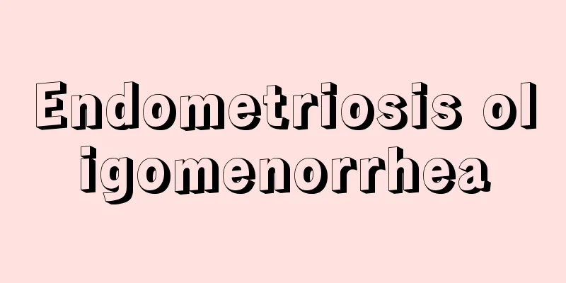 Endometriosis oligomenorrhea